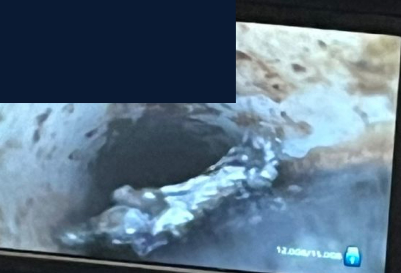 Trozo de sarro suelto atravesado en el ducto